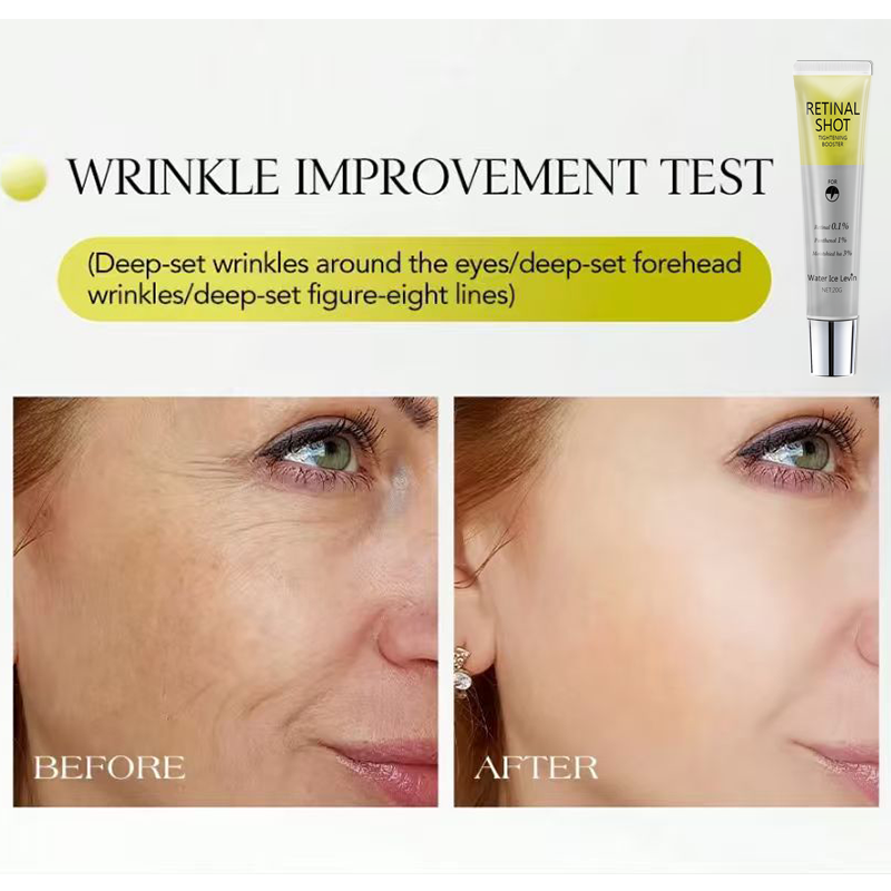 Retinal 0,1% dengan kandungan  - Retinol Anti Wrinkle Cream ulasan dan harga